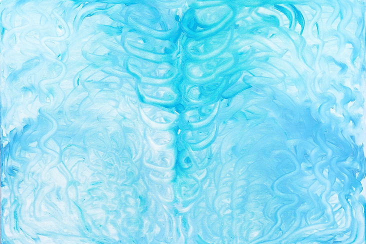 Alternate decription